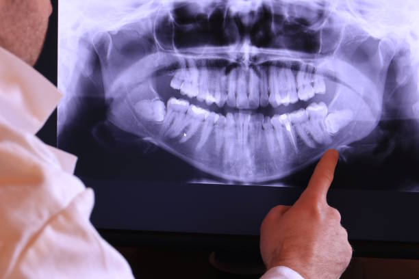 Best Emergency Treatment for Dental Infections or Abscesses in Kotlik, AK